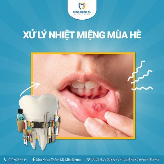 Hình ảnh bài viết