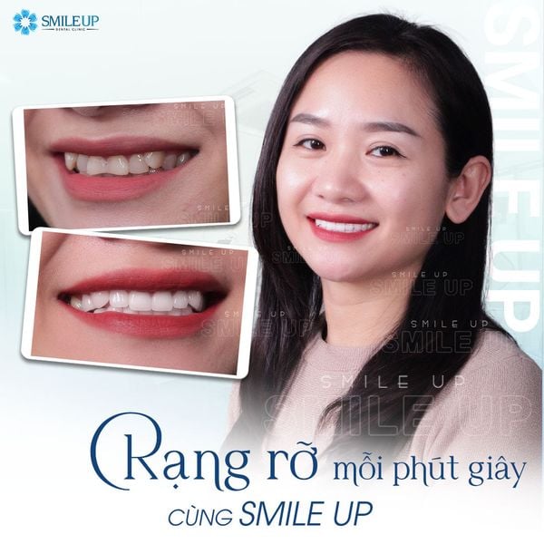 Hình ảnh bài viết