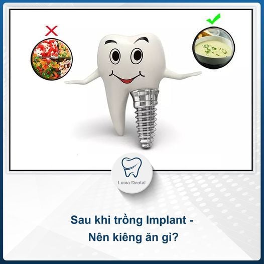 Hình ảnh bài viết