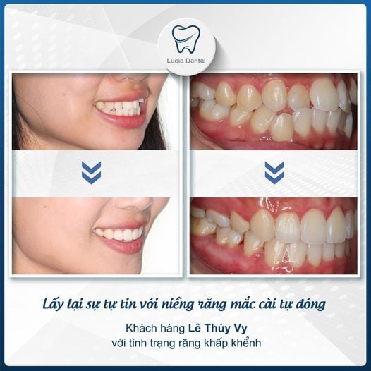 Hình ảnh bài viết
