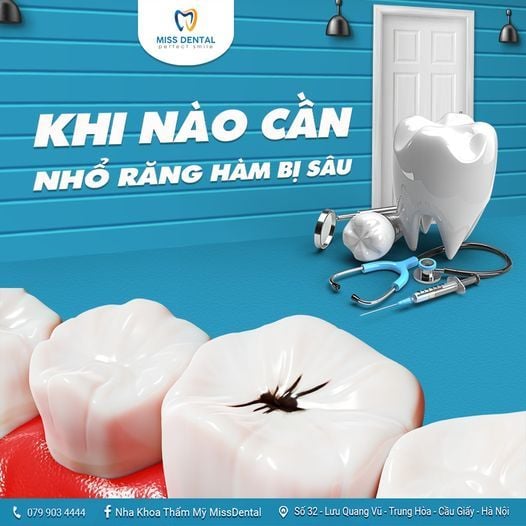 Hình ảnh bài viết