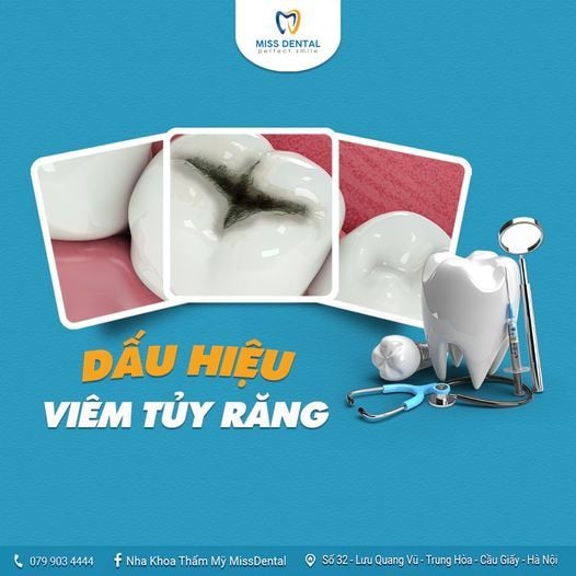 Hình ảnh bài viết