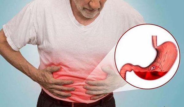 Hình ảnh bài viết