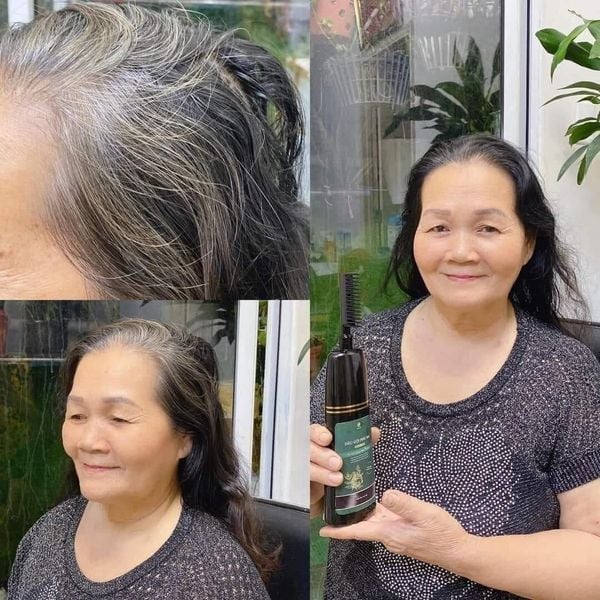 Hình ảnh bài viết