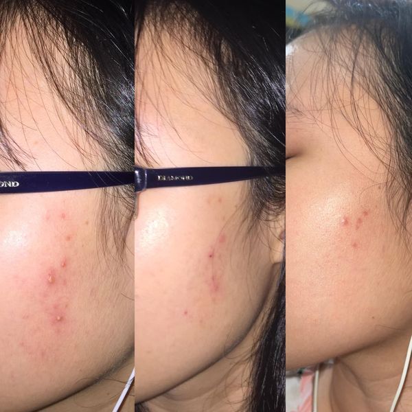 Hình ảnh bài viết