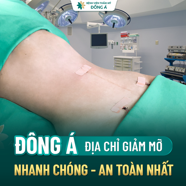 Hình ảnh bài viết