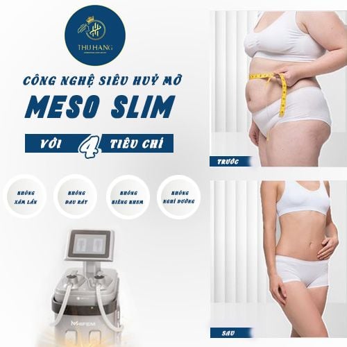 Mẫu content giảm cân – Thu Hằng Spa