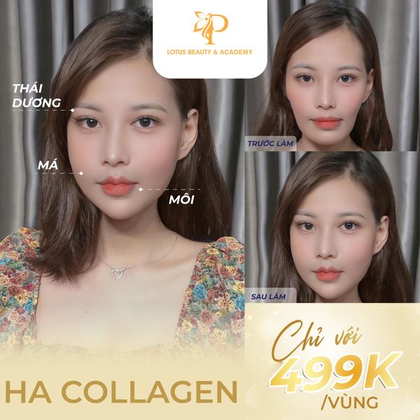 Mẫu content hay về Spa - Lotus Beauty & Academy