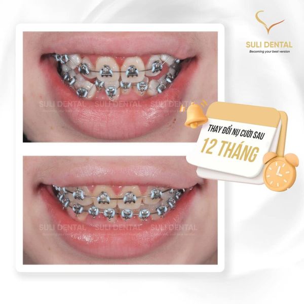 Hình ảnh bài viết