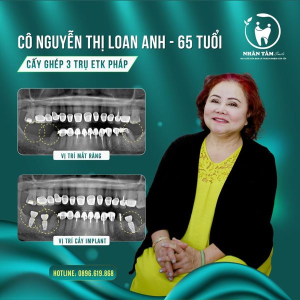 Hình ảnh bài viết
