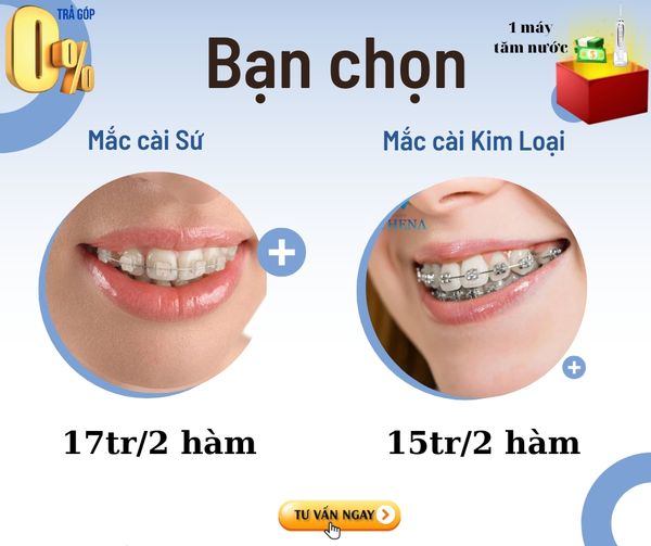 Hình ảnh bài viết