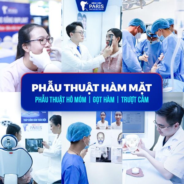 Hình ảnh bài viết