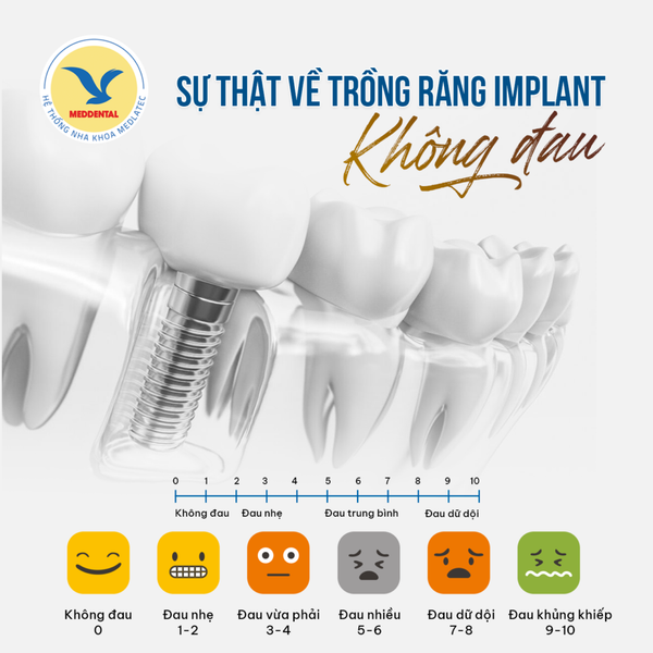 Hình ảnh bài viết