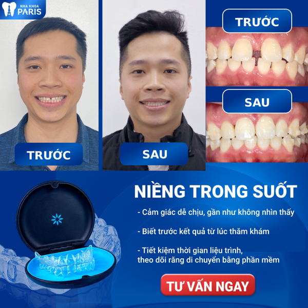Hình ảnh bài viết