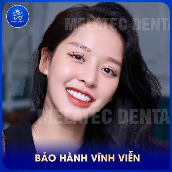 Hình ảnh bài viết