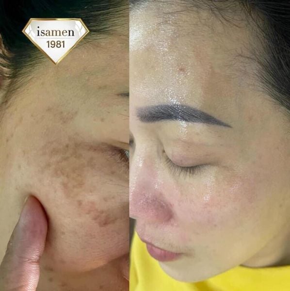 Hình ảnh bài viết