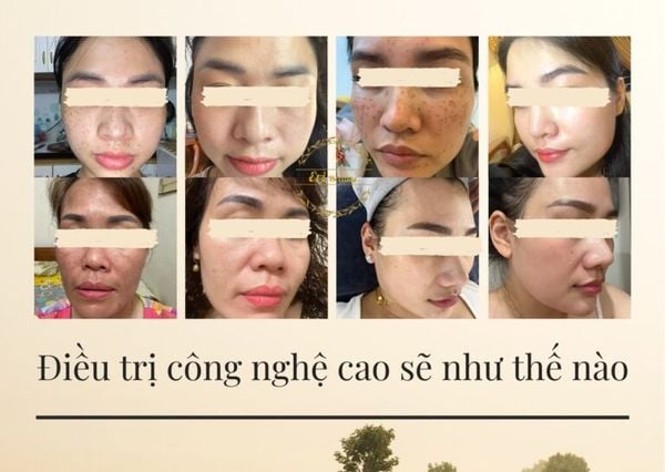 Hình ảnh bài viết