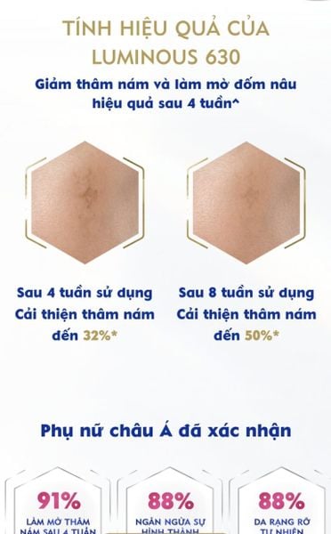 Hình ảnh bài viết