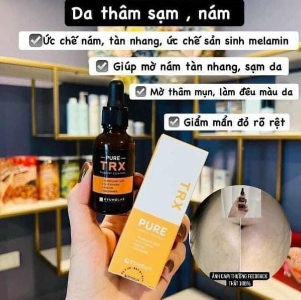 Hình ảnh bài viết