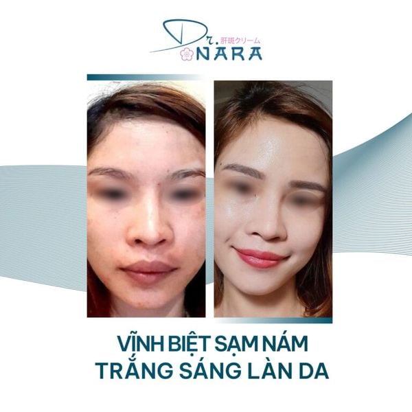 Hình ảnh bài viết