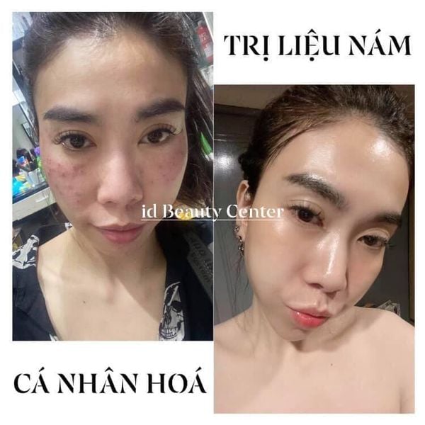 Hình ảnh bài viết