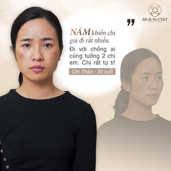 Hình ảnh bài viết