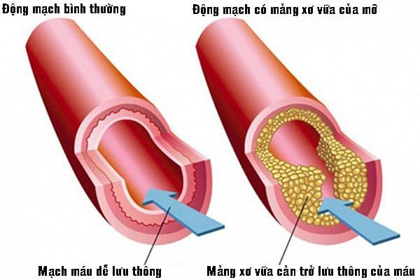 Hình ảnh bài viết