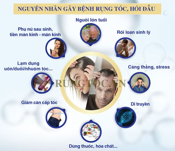 Hình ảnh bài viết