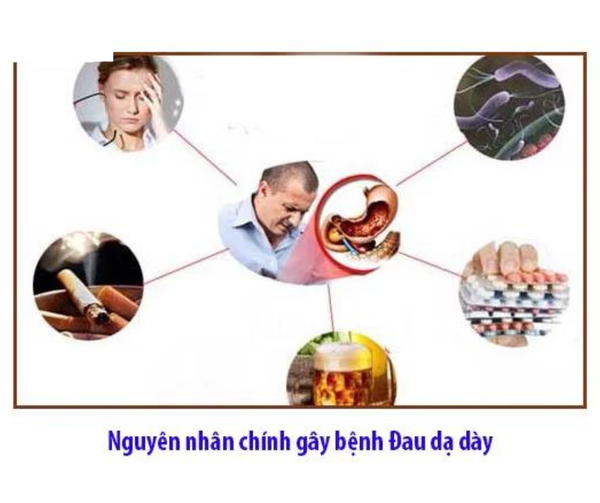 Hình ảnh bài viết