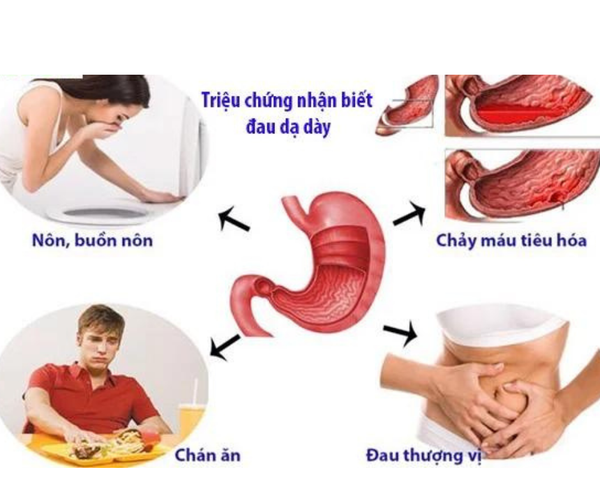 Hình ảnh bài viết