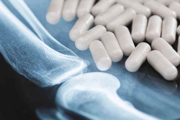 Tiêu chí lựa chọn thực phẩm chức năng xương khớp