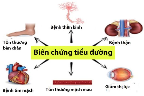 Sử dụng thực phẩm chức năng tiểu đường giúp phòng ngừa và hạn chế các biến chứng nguy hiểm