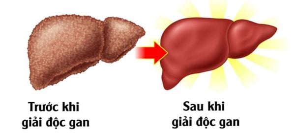 Vì sao phải thải độc gan thường xuyên?