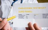 Cholesterol toàn phần là gì?