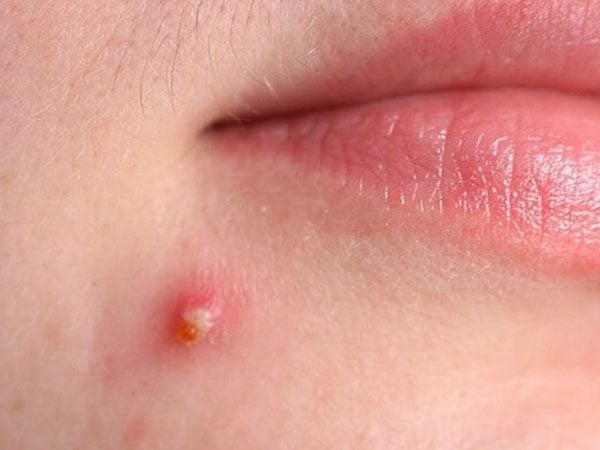 11 dấu hiệu cảnh báo độc tố trong cơ thể