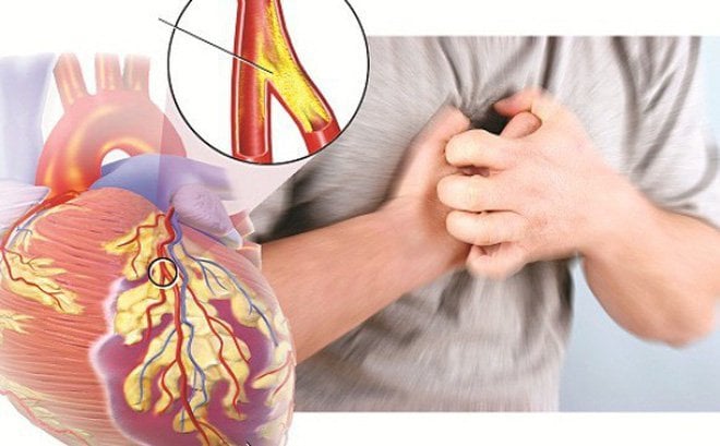 Động mạch vành: Hệ thống mạch máu sống còn của tim