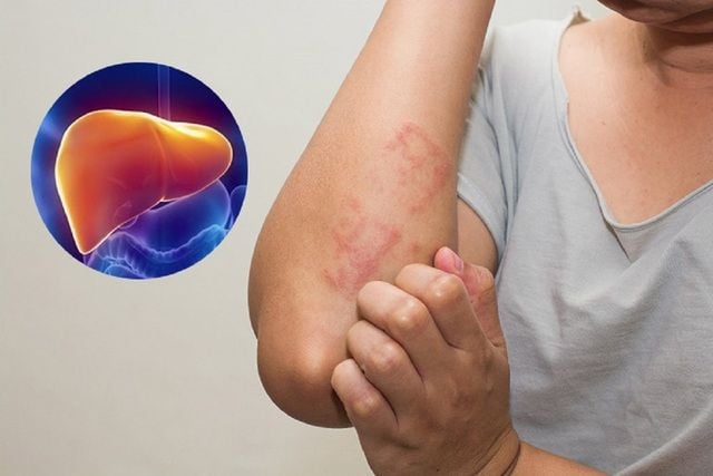 Gan thải độc qua da: Sự thật khoa học và quan niệm dân gian