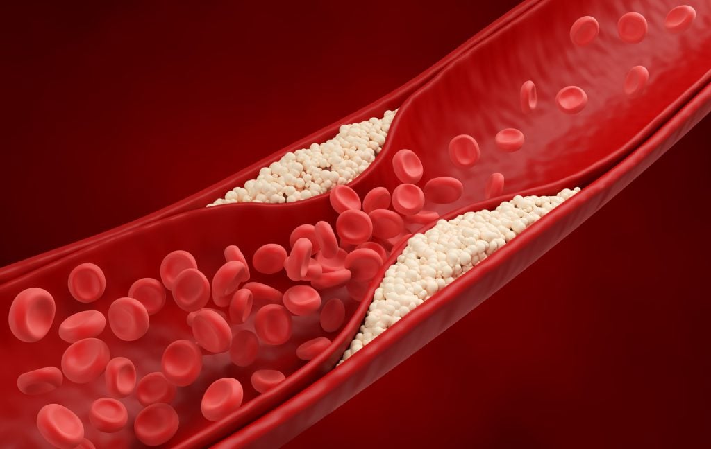 Khí huyết lưu thông kém: Nguyên nhân, dấu hiệu và phương pháp điều trị