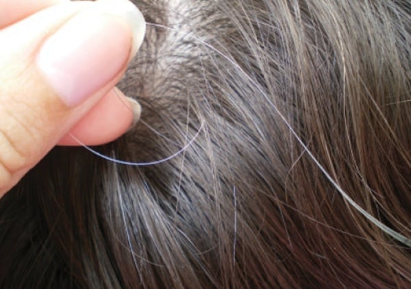 Tóc bạc ở người trẻ: Nguyên nhân và giải pháp đến từ y học cổ truyền