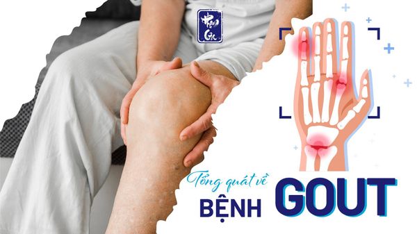 Tổng quát về bệnh gout