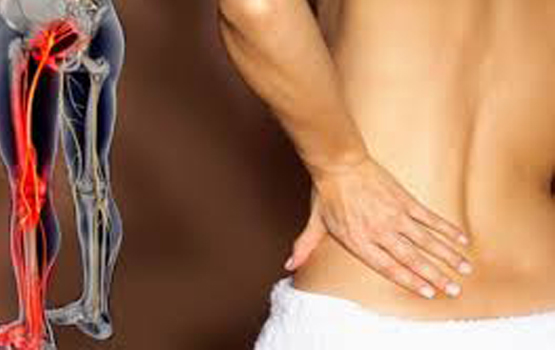 Giảm Đau Thần Kinh Tọa Với 9 Loại Thảo Dược Hiệu Quả