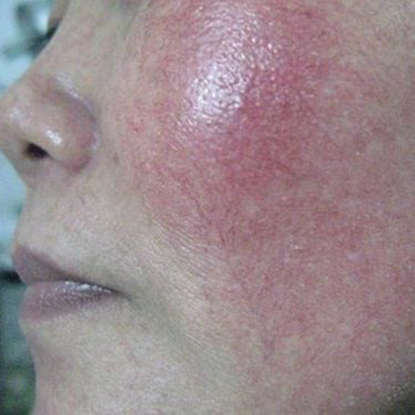 kem trộn trắng da thần tốc
