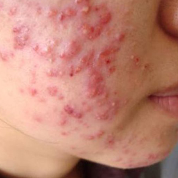 sự thật đằng sau kem trộn