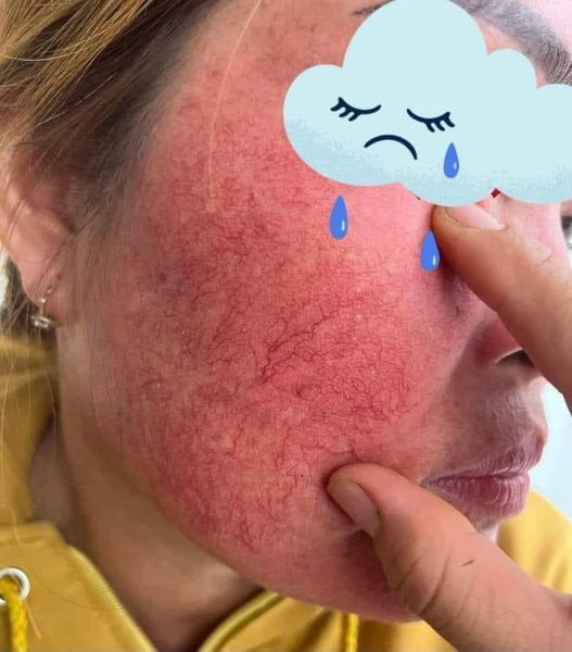 kem trộn trắng da thần tốc