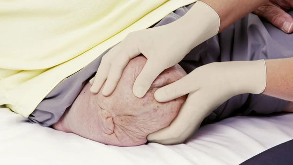 chân tay giả quận 7