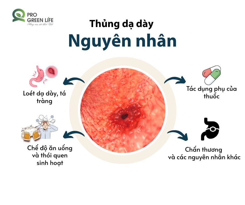 THỦNG DẠ DÀY - NGUYÊN NHÂN DO ĐÂU?