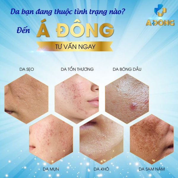 CHĂM SÓC DA MẶT– SPA