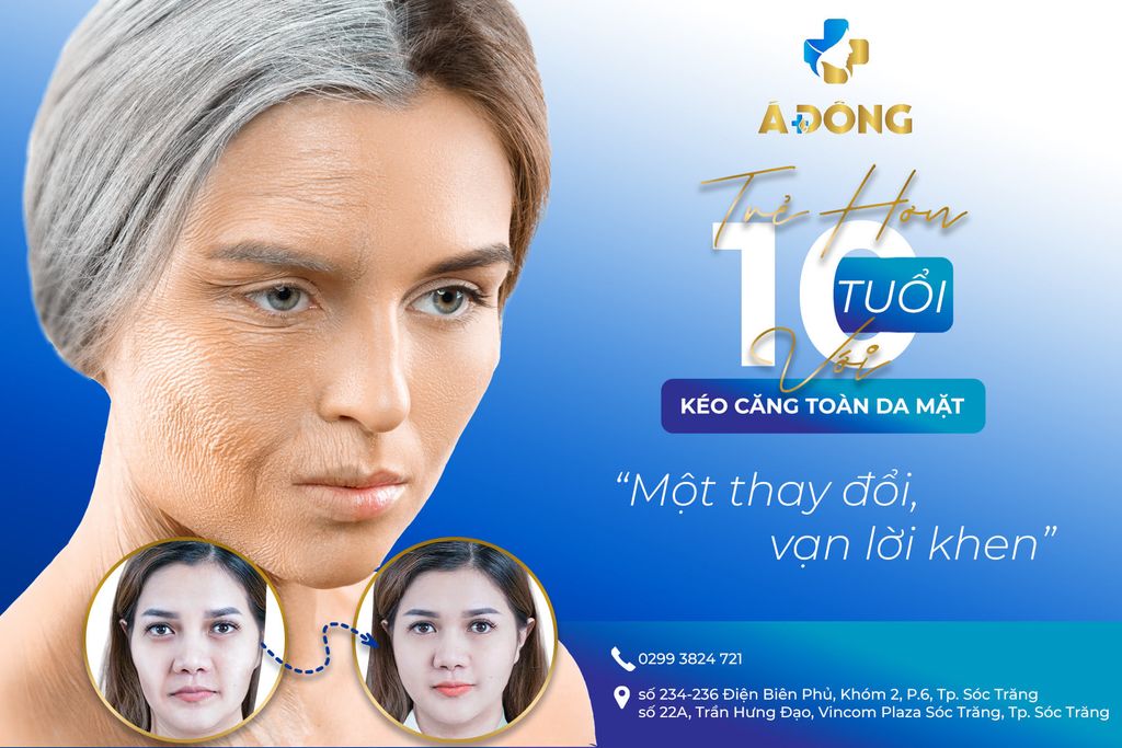 Trẻ Hoá 10 Tuổi Với Kéo Căng Toàn Da Mặt