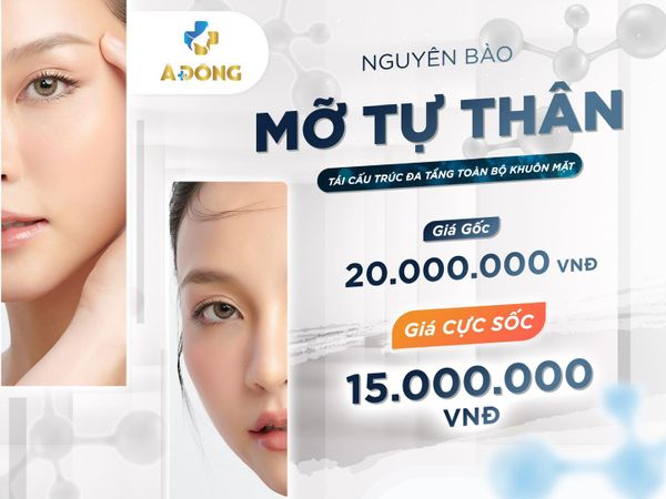 Cấy Nguyên Bào Mỡ Tự Thân