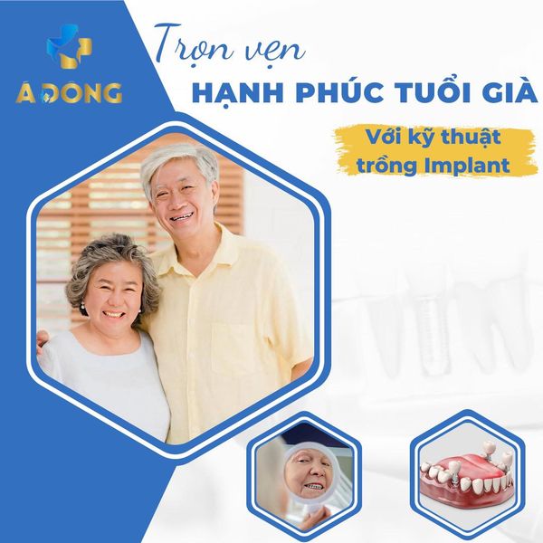 Trồng Răng Implant - Cứu Tinh Của Tuổi Già